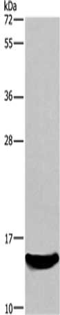 Gel: 10%SDS-PAGE,Lysate: 40 μg,,Primary antibody: AIF1 Antibody(AIF1 Antibody) at dilution 1/500 dilution,Secondary antibody: Goat anti rabbit IgG at 1/8000 dilution,Exposure time: 4 minutesRabbit anti-Human AIF1 Polyclonal Antibody