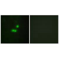 Immunofluorescence analysis of MCF-7cells, using TF3B antibody.