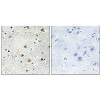 Immunohistochemistry analysis of paraffin-embedded human brain tissue using TF3B antibody.