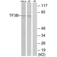 Western blot analysis of extracts from HeLa cells and Jurkat cells, using TF3B antibody.