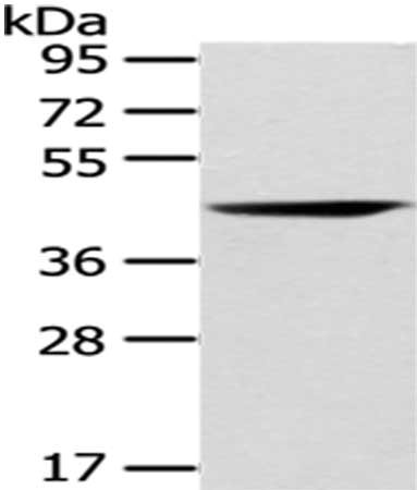 Gel: 8%SDS-PAGE,Lysate: 40 μg,,Primary antibody: CHGA Antibody(CHGA  Antibody) at dilution 1/200 dilution,Secondary antibody: Goat anti rabbit IgG at 1/8000 dilution,Exposure time: 10 minutesRabbit anti-Human CHGA Polyclonal Antibody