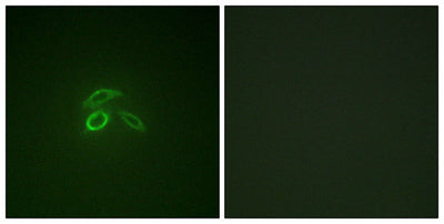 Immunofluorescence staining of methanol-fixed HepG2 cells using CD227/MUC1 (Phospho-Tyr1229) Antibody.Rabbit anti-Human MUC1 Polyclonal Antibody