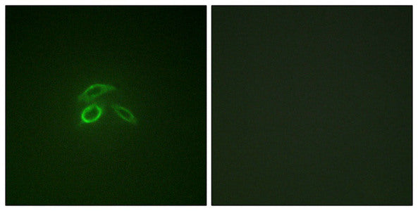Immunofluorescence staining of methanol-fixed HepG2 cells using CD227/MUC1 (Phospho-Tyr1229) Antibody.Rabbit anti-Human MUC1 Polyclonal Antibody