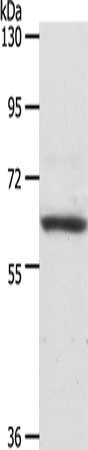 Gel: 10%SDS-PAGE, Lysate: 40 μg, Lane: NIH/3T3 cells, Primary antibody: PTPN6 Antibody(PTPN6 Antibody) at dilution 1/550, Secondary antibody: Goat anti rabbit IgG at 1/8000 dilution, Exposure time: 1 minuteRabbit anti-Human PTPN6 Polyclonal Antibody