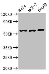 Western Blot  | Positive WB detected in: Hela whole cell lysate, MCF-7 whole cell lysate, HepG2 whole cell lysate  | All lanes: CHRNB1 antibody at 3µg/ml  | Secondary  | Goat polyclonal to rabbit IgG at 1/50000 dilution  | Predicted band size: 57, 50 kDa  | Observed band size: 57 kDaRabbit anti-Human CHRNB1 Polyclonal Antibody