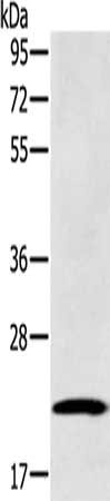 Gel: 8%SDS-PAGE, Lysate: 40 μg, Lane: Human fetal brain tissue, Primary antibody: RAB39B Antibody(RAB39B Antibody) at dilution 1/400, Secondary antibody: Goat anti rabbit IgG at 1/8000 dilution, Exposure time: 3 minutesRabbit anti-Human RAB39B Polyclonal Antibody