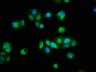 Immunofluorescence staining of HepG2 cells with TTN Antibody at 1:100, counter-stained with DAPI. The cells were fixed in 4% formaldehyde, permeabilized using 0.2% Triton X-100 and blocked in 10% normal Goat Serum. The cells were then incubated with the antibody overnight at 4°C. The secondary antibody was Alexa Fluor 488-congugated AffiniPure Goat Anti-Rabbit IgG(H+L).Rabbit anti-Human TTN Polyclonal Antibody