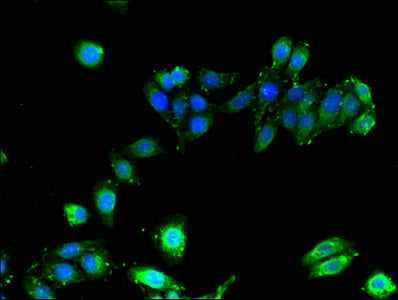 Immunofluorescent analysis of HepG2 cells using HLA-B Antibody at dilution of 1:100Rabbit anti-Human HLA-B Polyclonal Antibody