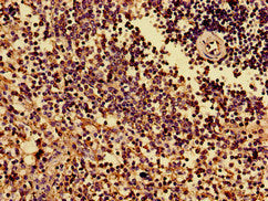 Immunohistochemistry of paraffin-embedded human spleen tissue using HLA-B Antibody at dilution of 1:100Rabbit anti-Human HLA-B Polyclonal Antibody