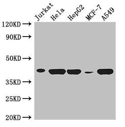 Western Blot  | Positive WB detected in: Jurkat whole cell lysate, Hela whole cell lysate, HepG2 whole cell lysate, MCF-7 whole cell lysate, A549 whole cell lysate  | All lanes: HLA-B antibody at 3µg/ml  | Secondary  | Goat polyclonal to rabbit IgG at 1/50000 dilution  | Predicted band size: 41 kDa  | Observed band size: 41 kDaRabbit anti-Human HLA-B Polyclonal Antibody