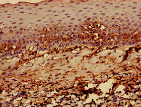 Immunohistochemistry of paraffin-embedded human tonsil tissue using HLA-C Antibody at dilution of 1:100Rabbit anti-Human HLA-C Polyclonal Antibody