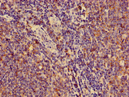 Immunohistochemistry of paraffin-embedded human lymph node tissue using HLA-C Antibody at dilution of 1:100Rabbit anti-Human HLA-C Polyclonal Antibody