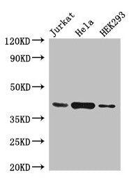 Western Blot  | Positive WB detected in: Jurkat whole cell lysate, Hela whole cell lysate, HEK293 whole cell lysate  | All lanes: HLA-C antibody at 4µg/ml  | Secondary  | Goat polyclonal to rabbit IgG at 1/50000 dilution  | Predicted band size: 41 kDa  | Observed band size: 41 kDaRabbit anti-Human HLA-C Polyclonal Antibody