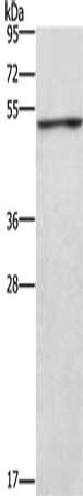 Gel: 8%SDS-PAGE, Lysate: 40 μg, Lane: Jurkat cells, Primary antibody: CKMT2 Antibody(CKMT2 Antibody) at dilution 1/700, Secondary antibody: Goat anti rabbit IgG at 1/8000 dilution, Exposure time: 10 secondsRabbit anti-Human CKMT2 Polyclonal Antibody