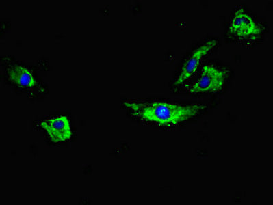 Immunofluorescent analysis of Hela cells using RYR2 Antibody at dilution of 1:100 and Alexa Fluor 488-congugated AffiniPure Goat Anti-Rabbit IgG(H+L)Rabbit anti-Human RYR2 Polyclonal Antibody