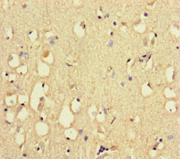 Immunohistochemistry of paraffin-embedded human brain tissue using the antibody at dilution of 1:100Rabbit anti-Human RYR2 Polyclonal Antibody