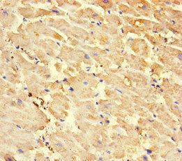 Immunohistochemistry of paraffin-embedded human heart tissue using RYR2 Antibody at dilution of 1:100Rabbit anti-Human RYR2 Polyclonal Antibody