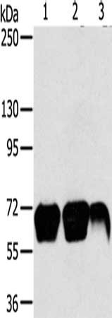Gel: 6%SDS-PAGE, Lysate: 40 μg, Lane 1-3: K562 cells, Jurkat cells, hepg2 cells, Primary antibody: MMP9 Antibody(MMP9 Antibody) at dilution 1/200, Secondary antibody: Goat anti rabbit IgG at 1/8000 dilution, Exposure time: 1 minuteRabbit anti-Human MMP9 Polyclonal Antibody
