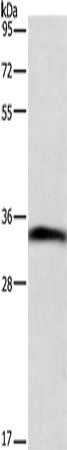 Gel: 8%SDS-PAGE, Lysate: 60 μg, Lane: Mouse small intestine tissue, Primary antibody: ANXA13 Antibody(ANXA13 Antibody) at dilution 1/200, Secondary antibody: Goat anti rabbit IgG at 1/8000 dilution, Exposure time: 3 minutesRabbit anti-Human ANXA13 Polyclonal Antibody