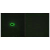 Immunofluorescence analysis of HeLa cells, using TNF12 antibody.Rabbit anti-Human TNFSF12 Polyclonal Antibody