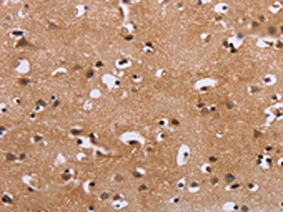 The image on the left is immunohistochemistry of paraffin-embedded Human brain tissue using MAPK1/MAPK3 Antibody(MAPK1/MAPK3 Antibody) at dilution 1/30, on the right is treated with synthetic peptide. (Original magnification: ×200)