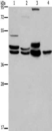 Gel: 8%SDS-PAGE,Lysate: 40 μg,Lane 1-4: 293T cells, Human brain malignant glioma tissue, Mouse brain tissue, Human hepatocellsular carcinoma tissue,Primary antibody: MAPK1/MAPK3 Antibody(MAPK1/MAPK3 Antibody) at dilution 1/550 dilution,Secondary antibody: Goat anti rabbit IgG at 1/8000 dilution,Exposure time: 20 seconds