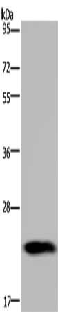 Gel: 10%SDS-PAGE, Lysate: 40 μg, Lane: Human placenta tissue, Primary antibody: GH2 Antibody(GH2 Antibody) at dilution 1/700, Secondary antibody: Goat anti rabbit IgG at 1/8000 dilution, Exposure time: 10 secondsRabbit anti-Human GH2 Polyclonal Antibody