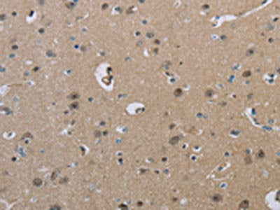 The image on the left is immunohistochemistry of paraffin-embedded Human brain  tissue using HSD3B1 Antibody(HSD3B1 Antibody) at dilution 1/40, on the right is treated with fusion protein. (Original magnification: ×200)Rabbit anti-Human HSD3B1 Polyclonal Antibody