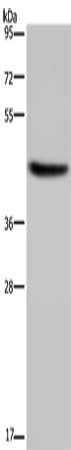 Gel: 8%SDS-PAGE, Lysate: 40 μg, Lane: Human adrenal gland tissue, Primary antibody: HSD3B1 Antibody(HSD3B1 Antibody) at dilution 1/250, Secondary antibody: Goat anti rabbit IgG at 1/8000 dilution, Exposure time: 3 minutesRabbit anti-Human HSD3B1 Polyclonal Antibody