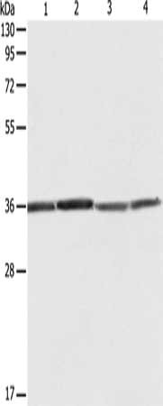 Gel: 10%SDS-PAGE, Lysate: 40 μg, Lane 1-4: Hela cells, 293T cells, A431 cells, Jurkat cells, Primary antibody: RPLP0 Antibody(RPLP0 Antibody) at dilution 1/600, Secondary antibody: Goat anti rabbit IgG at 1/8000 dilution, Exposure time: 1 minuteRabbit anti-Human RPLP0 Polyclonal Antibody