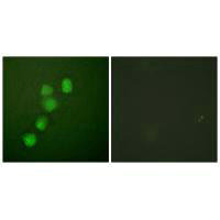 Immunofluorescence analysis of HuvEc cells, using Cyclin E1 (Ab-395) antibody.Rabbit anti-Human CCNE1 Polyclonal Antibody