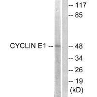 Western blot analysis of extracts from HeLa cells, treated with Paclitasel (1uM, 60mins), using Cyclin E1 (Ab-395) antibody.