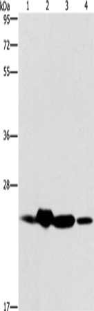 Gel: 10%SDS-PAGE, Lysate: 40 μg, Lane 1-4: Mouse spleen tissue, human fetal liver tissue, hela cells, human fetal brain tissue, Primary antibody: THOC7 Antibody(THOC7 Antibody) at dilution 1/450, Secondary antibody: Goat anti rabbit IgG at 1/8000 dilution, Exposure time: 20 secondsRabbit anti-Human THOC7 Polyclonal Antibody