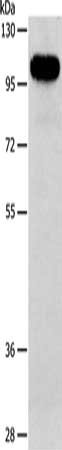 Gel: 8%SDS-PAGE, Lysate: 40μg, Lane: A172 cells, Primary antibody: AFAP1 Antibody(AFAP1 Antibody) at dilution 1/134, Secondary antibody: Goat anti rabbit IgG at 1/8000 dilution, Exposure time: 10 secondsRabbit anti-Human AFAP1 Polyclonal Antibody