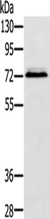 Gel: 8%SDS-PAGE, Lysate: 40 μg, Lane: Hepg2 cells, Primary antibody: SSX2IP Antibody(SSX2IP Antibody) at dilution 1/500, Secondary antibody: Goat anti rabbit IgG at 1/8000 dilution, Exposure time: 10 secondsRabbit anti-Human SSX2IP Polyclonal Antibody