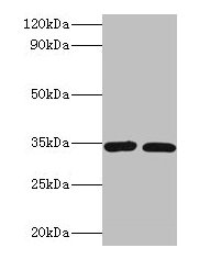 Western blot  | All lanes: CASP7 antibody at 2µg/ml  | Lane 1: A549 whole cell lysate  | Lane 2: HGC-27 whole cell lysate  | Secondary  | Goat polyclonal to rabbit IgG at 1/10000 dilution  | Predicted band size: 35, 29, 38, 32 kDa  | Observed band size: 35 kDa