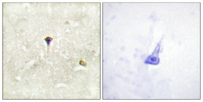 Immunohistochemistry analysis of paraffin-embedded human brain tissue, using ALK (Phospho-Tyr1604) antibody. The picture on the right is treated with the synthesized peptide.Rabbit anti-Human ALK Polyclonal Antibody