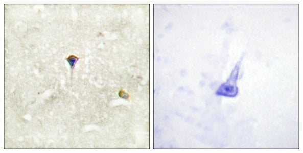 Immunohistochemistry analysis of paraffin-embedded human brain tissue, using ALK (Phospho-Tyr1604) antibody. The picture on the right is treated with the synthesized peptide.Rabbit anti-Human ALK Polyclonal Antibody