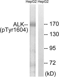 Western blot analysis of extracts from HepG2 cells, using ALK (Phospho-Tyr1604) antibody. The lane on the right is treated with the synthesized peptide.Rabbit anti-Human ALK Polyclonal Antibody