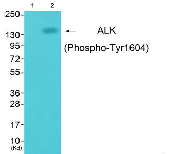 Western blot analysis of extracts from cos-7 cells (Lane 2), using ALK (Phospho-Tyr1604) Antibody. The lane on the left is treated with synthesized peptide.Rabbit anti-Human ALK Polyclonal Antibody