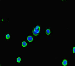 Immunofluorescent analysis of MCF-7 cells using ATG5 Antibody at dilution of 1:100 and Alexa Fluor 488-congugated AffiniPure Goat Anti-Rabbit IgG(H+L)
