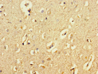 Immunohistochemistry of paraffin-embedded human brain tissue using ATG5 Antibody at dilution of 1:100