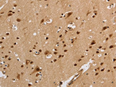 The image on the left is immunohistochemistry of paraffin-embedded Human brain  tissue using KCNG4 Antibody(KCNG4 Antibody) at dilution 1/40, on the right is treated with synthetic peptide. (Original magnification: ×200)Rabbit anti-Human KCNG4 Polyclonal Antibody