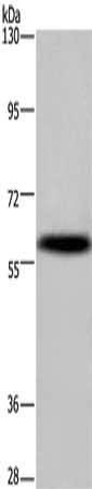 Gel: 6%SDS-PAGE, Lysate: 40 μg, Lane: Mouse brain tissue, Primary antibody: KCNG4 Antibody(KCNG4 Antibody) at dilution 1/500, Secondary antibody: Goat anti rabbit IgG at 1/8000 dilution, Exposure time: 10 secondsRabbit anti-Human KCNG4 Polyclonal Antibody