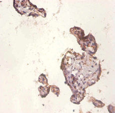 Immunohistochemistry of paraffin-embedded human placenta tissue using the antibody at dilution of 1:50Rabbit anti-Human WNT3A Polyclonal Antibody