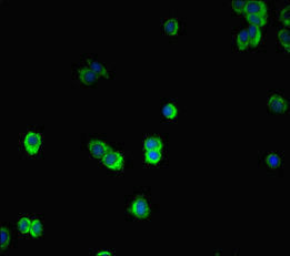 Immunofluorescent analysis of HepG2 cells using SMAD2 Antibody at dilution of 1:100 and Alexa Fluor 488-congugated AffiniPure Goat Anti-Rabbit IgG(H+L)Rabbit anti-Human SMAD2 Polyclonal Antibody