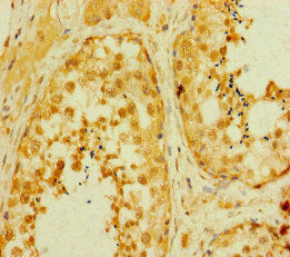 Immunohistochemistry of paraffin-embedded human testis tissue using SMAD2 Antibody at dilution of 1:100Rabbit anti-Human SMAD2 Polyclonal Antibody