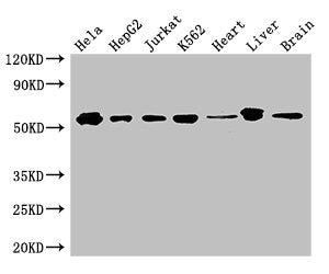 Western Blot | Positive WB detected in: Hela whole cell lysate, HepG2 whole cell lysate, Jurkat whole cell lysate, K562 whole cell lysate, Mouse heart tissue, Mouse liver tissue, Mouse brain tissue | All lanes: SMAD2 antibody at 3μg/ml | Secondary | Goat polyclonal to rabbit IgG at 1/50000 dilution | Predicted band size: 53, 49 kDa | Observed band size: 53 kDaRabbit anti-Human SMAD2 Polyclonal Antibody