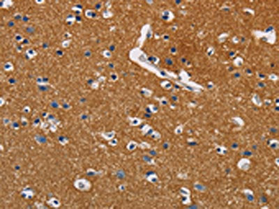 The image on the left is immunohistochemistry of paraffin-embedded Human brain tissue using the antibody Antibody) at dilution 1/40, on the right is treated with fusion protein. (Original magnification: ×200)Rabbit anti-Human GPM6A Polyclonal Antibody