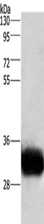 Gel: 8%SDS-PAGE, Lysate: 20 μg, Lane: Human fetal brain tissue, Primary antibody: GPM6A Antibody(GPM6A Antibody) at dilution 1/950, Secondary antibody: Goat anti rabbit IgG at 1/8000 dilution, Exposure time: 1 secondRabbit anti-Human GPM6A Polyclonal Antibody